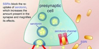 SSRI